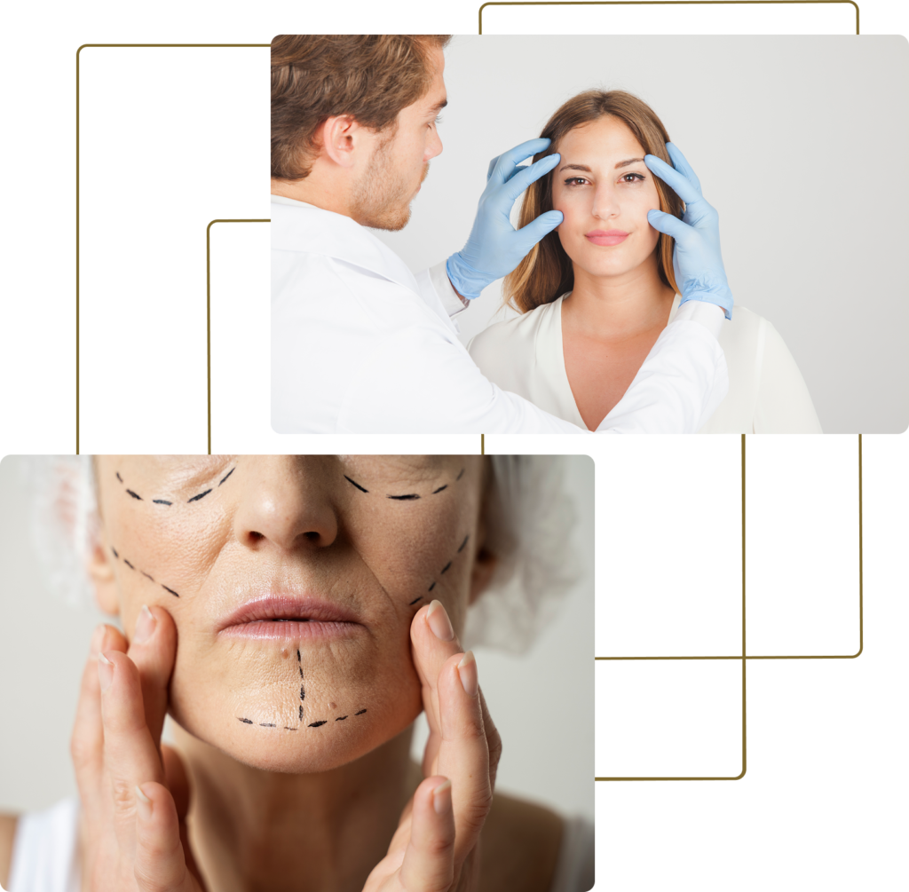 Group-271-1-1024x1005  INTENSIVO DE HARMONIZAÇÃO FACIAL