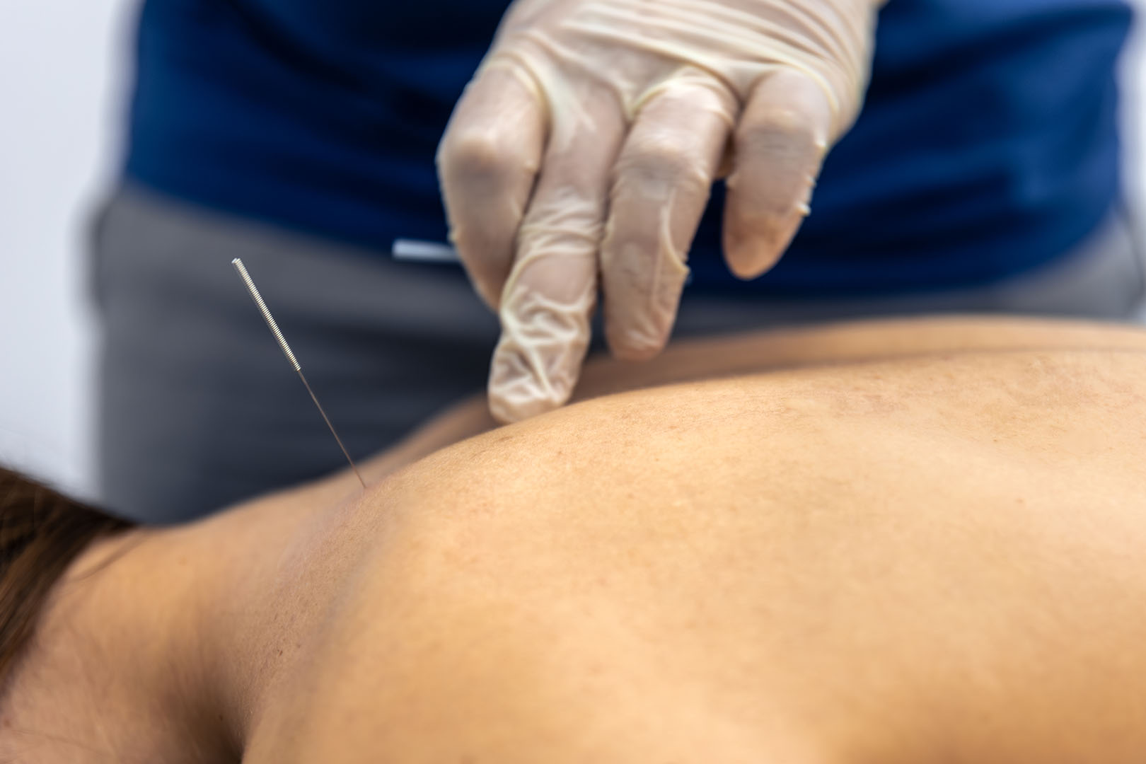 physiotherapist-checks-dry-needling-female-patient-back-point-control-check PÓS-GRADUAÇÃO