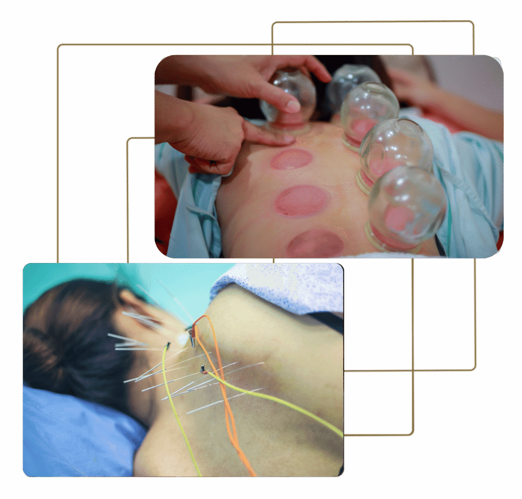 Dietoterapia-1024x979 ATUALIZAÇÃO EM DIETOTERAPIA E TECNOLOGIAS NA ACUPUNTURA